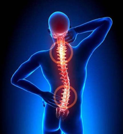 back-pain-causes-431x470